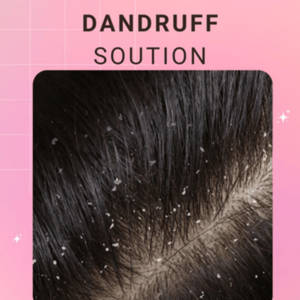 Dandruff (1)