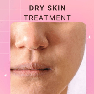 dry skin